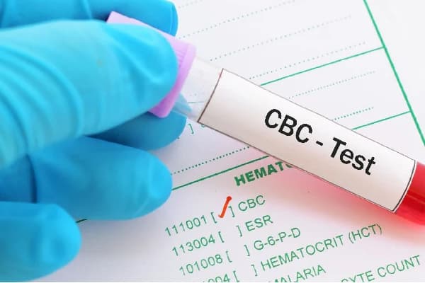 Complete Blood Count (CBC)