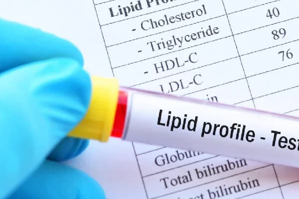Lipid Profile (Heart Test)