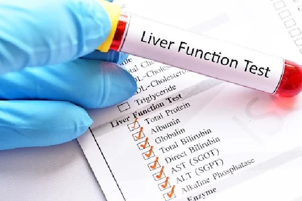 Liver Function Test (LFT)